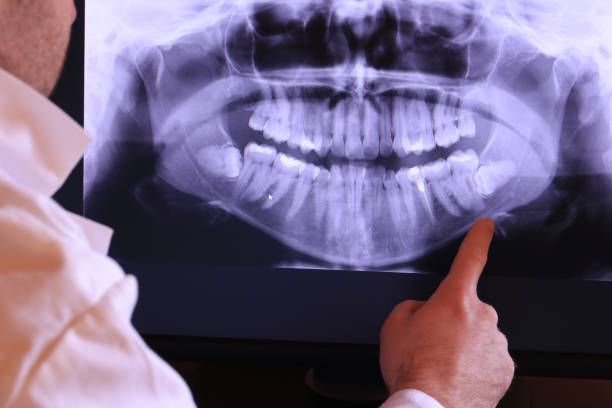 Best Broken or Cracked Tooth Emergency Dentist in Lincolnton, GA