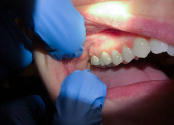 Best Mobile Emergency Dentist in Lincolnton, GA