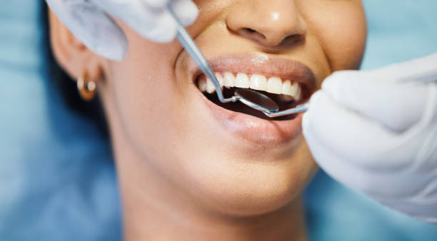 Best Broken or Cracked Tooth Emergency Dentist in Lincolnton, GA